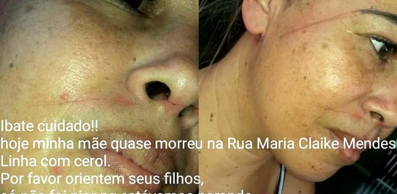 AAACEROL