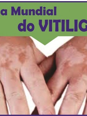 thumbnail_Dia Mundial do Vitiligo