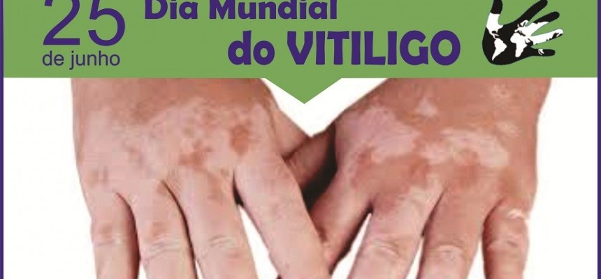 thumbnail_Dia Mundial do Vitiligo