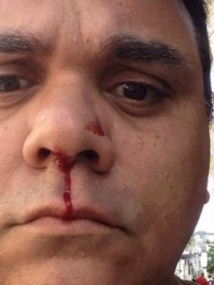 jeferson_apanha_790x505_11102018191129