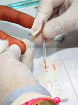 Teste-de-AIDS
