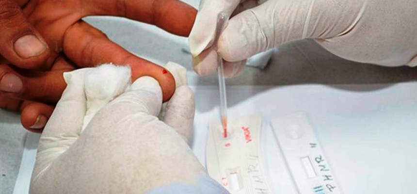 Teste-de-AIDS