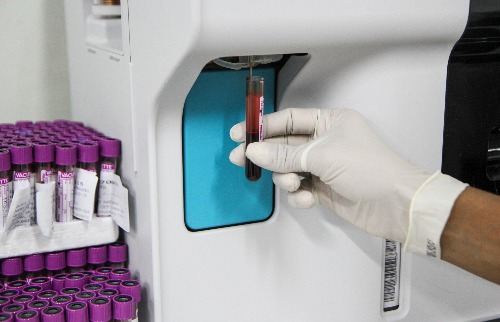 dengue_dengario_500x320_08042019173758