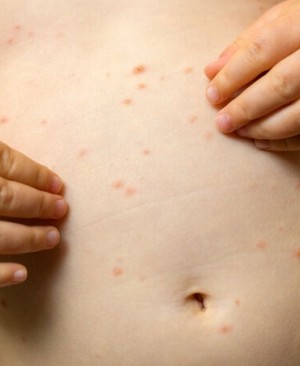 52f0eac204c07ceace4f8565e2d1026f_XL