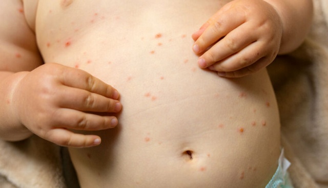 52f0eac204c07ceace4f8565e2d1026f_XL