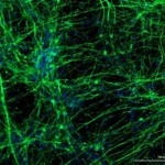 coronavirus-neuronios