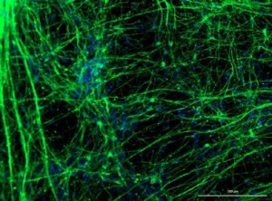 coronavirus-neuronios