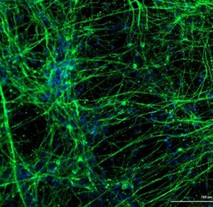 coronavirus-neuronios