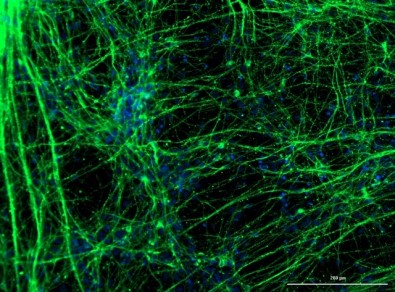 coronavirus-neuronios