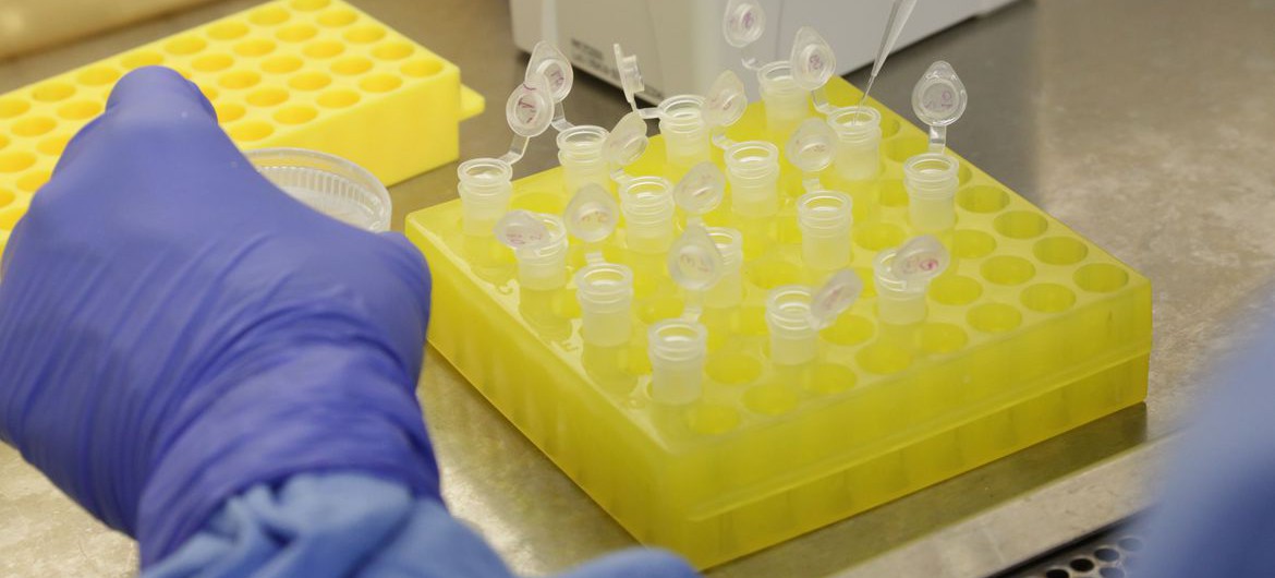 diagnostico_laboratorial_de_casos_suspeitos_do_novo_coronavirus_2801209411