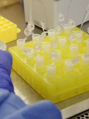 diagnostico_laboratorial_de_casos_suspeitos_do_novo_coronavirus_2801209411