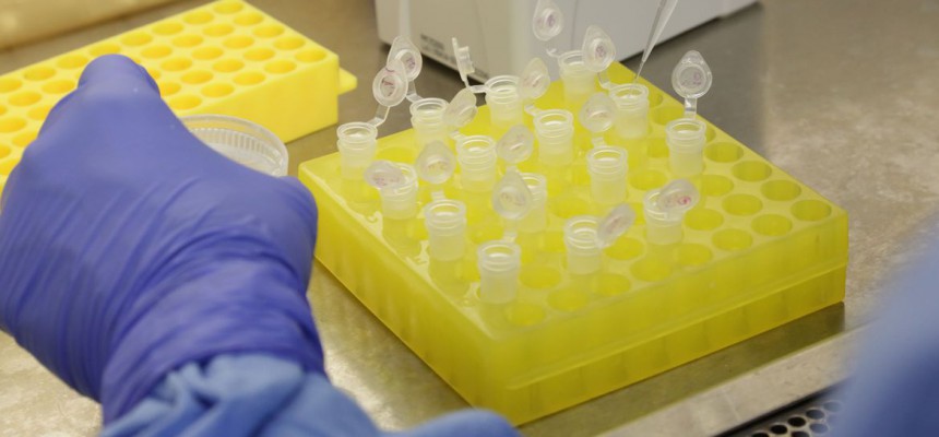 diagnostico_laboratorial_de_casos_suspeitos_do_novo_coronavirus_2801209411