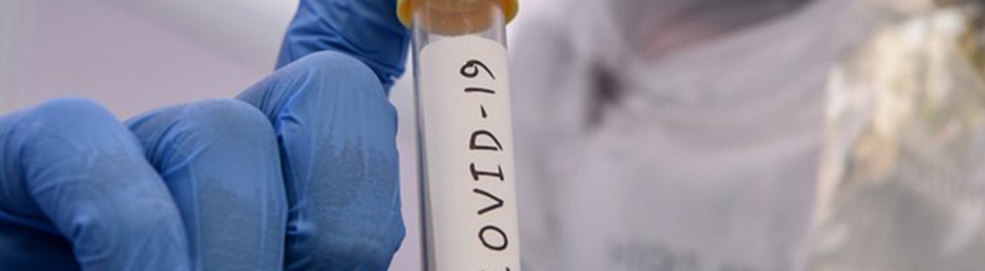 casa-de-carnes-e-fechada-para-desinfeccao-apos-casos-de-covid-9-iGlt