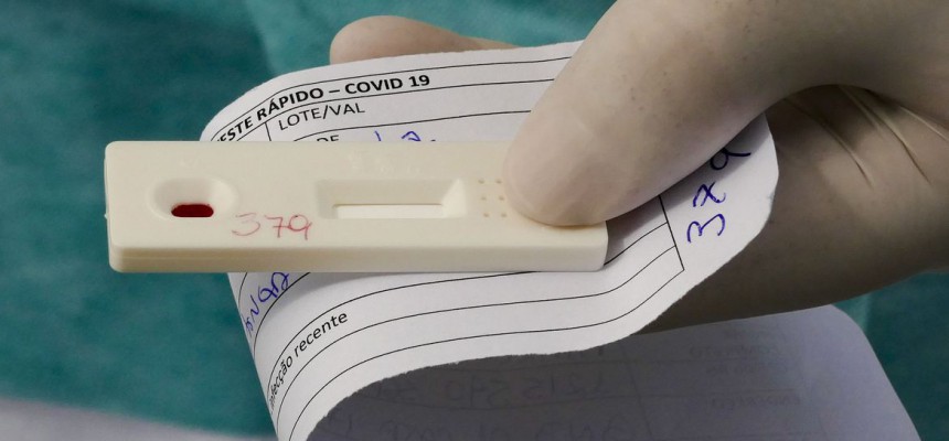 Teste 'drive-thru' para coronavírus